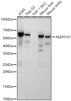 ALDH1A1 Rabbit PolyMonoclonal Antibody?