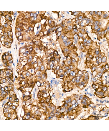 Caspase-9 Rabbit PolyMonoclonal Antibody?