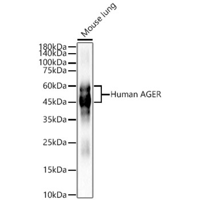 Human AGER Rabbit Polyclonal Antibody