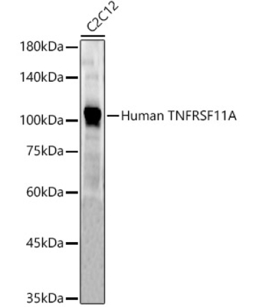 Human TNFRSF11A Rabbit Polyclonal Antibody