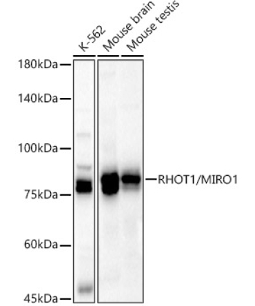 RHOT1/MIRO1 Rabbit Polyclonal Antibody [KD Validated]