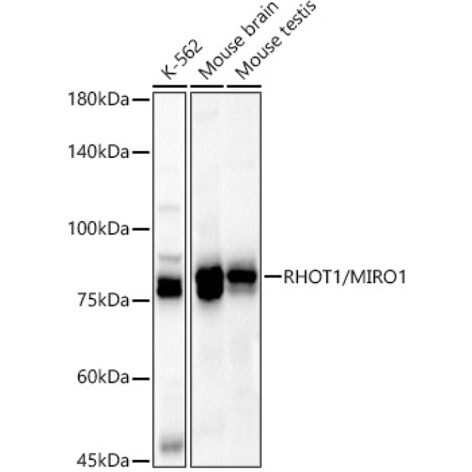 RHOT1/MIRO1 Rabbit Polyclonal Antibody [KD Validated]