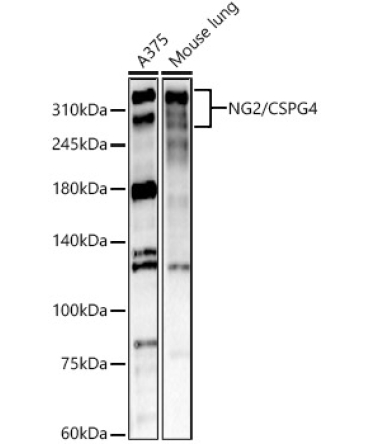 NG2/CSPG4 Rabbit Polyclonal Antibody