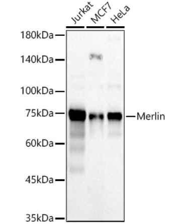 Merlin Rabbit Polyclonal Antibody