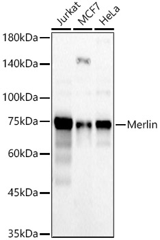 Merlin Rabbit Polyclonal Antibody