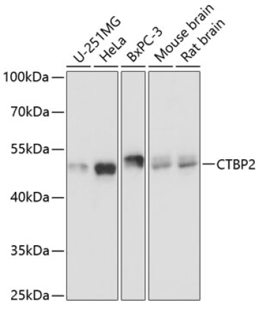 CTBP2 Rabbit Polyclonal Antibody