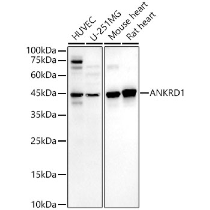 ANKRD1 Rabbit PolyMonoclonal Antibody?