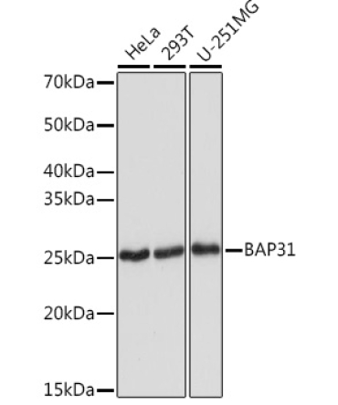 BAP31 Rabbit Monoclonal Antibody