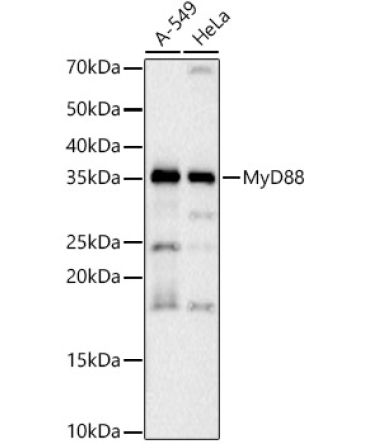 MyD88 Rabbit PolyMonoclonal Antibody [KO Validated]