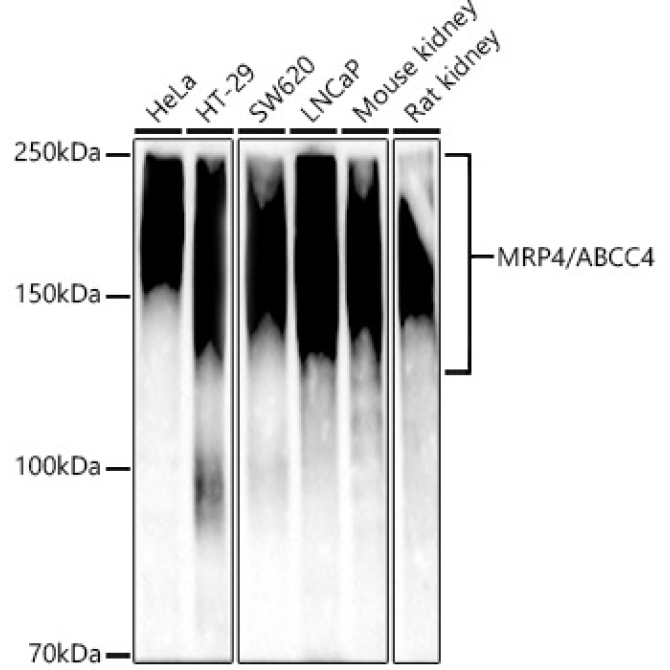 MRP4/ABCC4 Rabbit Monoclonal Antibody [KD Validated]