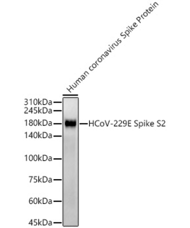 HCoV-229E Spike S2 Rabbit Monoclonal Antibody