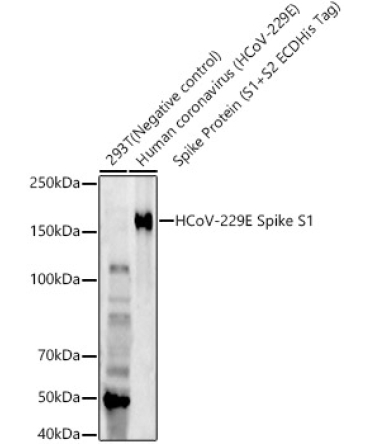 HCoV-229E Spike S1 Rabbit Monoclonal Antibody