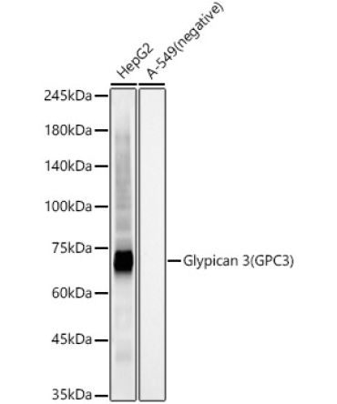 Glypican 3 (GPC3) Rabbit Monoclonal Antibody