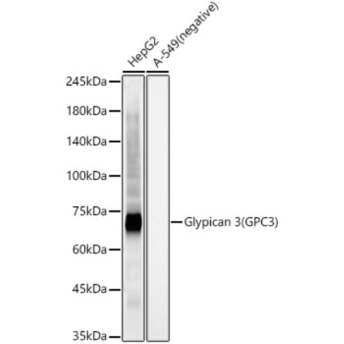 Glypican 3 (GPC3) Rabbit Monoclonal Antibody
