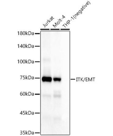 ITK/EMT Rabbit Monoclonal Antibody