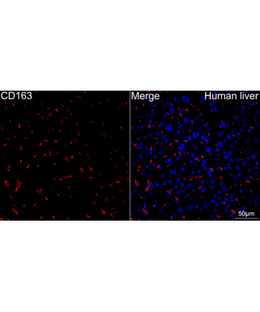 CD163 Rabbit Monoclonal Antibody