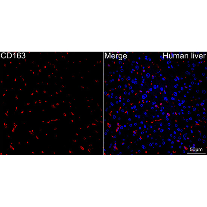 CD163 Rabbit Monoclonal Antibody