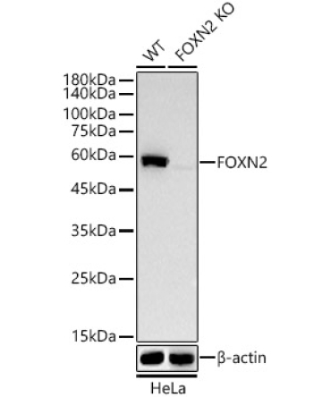 FOXN2 Rabbit Monoclonal Antibody [KO Validated]