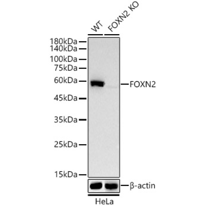 FOXN2 Rabbit Monoclonal Antibody [KO Validated]