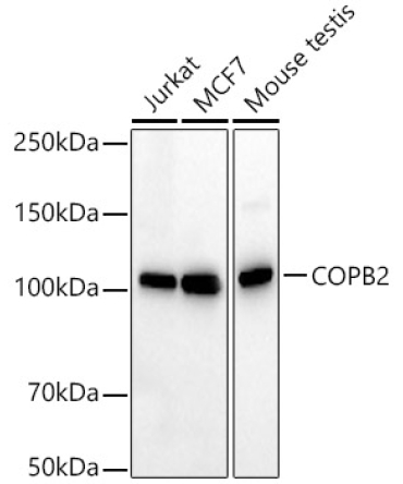 COPB2 Rabbit PolyMonoclonal Antibody [KD Validated]