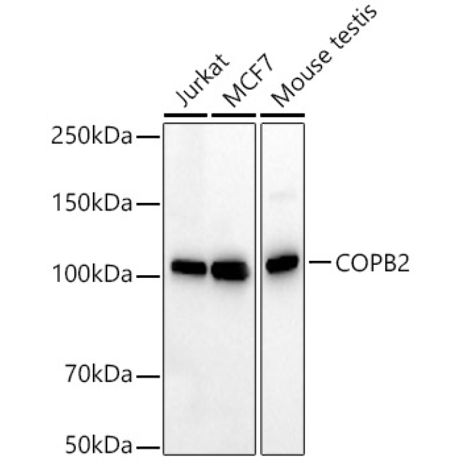 COPB2 Rabbit PolyMonoclonal Antibody [KD Validated]
