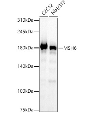 MSH6 Rabbit Monoclonal Antibody [KO Validated]