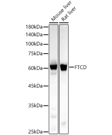FTCD Rabbit Monoclonal Antibody