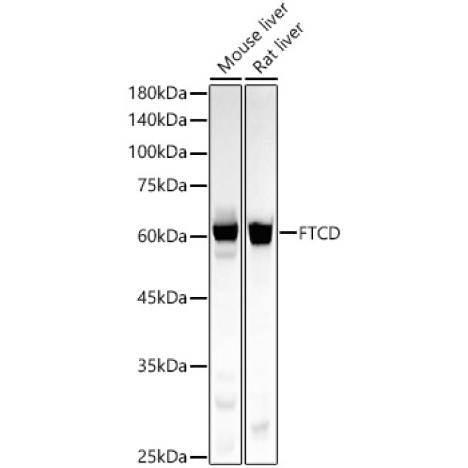 FTCD Rabbit Monoclonal Antibody