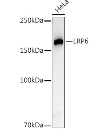 LRP6 Rabbit Monoclonal Antibody