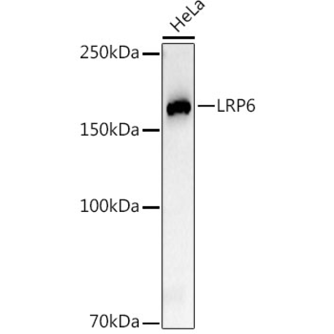 LRP6 Rabbit Monoclonal Antibody