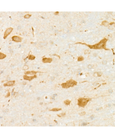 DARPP32 Rabbit Monoclonal Antibody
