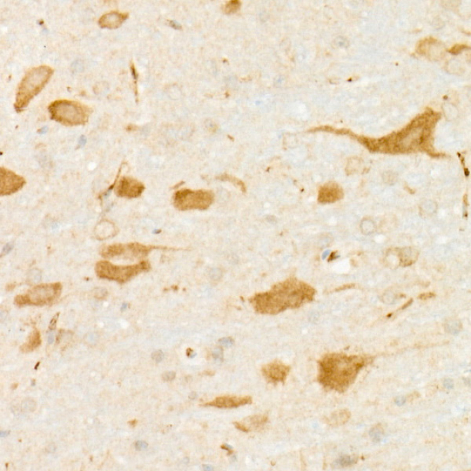 DARPP32 Rabbit Monoclonal Antibody
