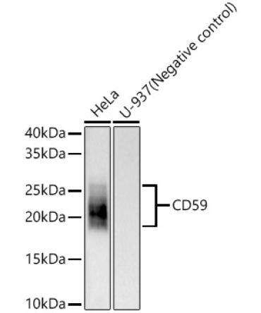 CD59 Rabbit Monoclonal Antibody