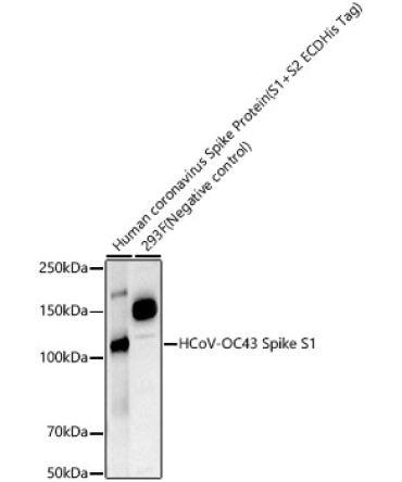 HCoV-OC43 Spike S1 Rabbit Monoclonal Antibody