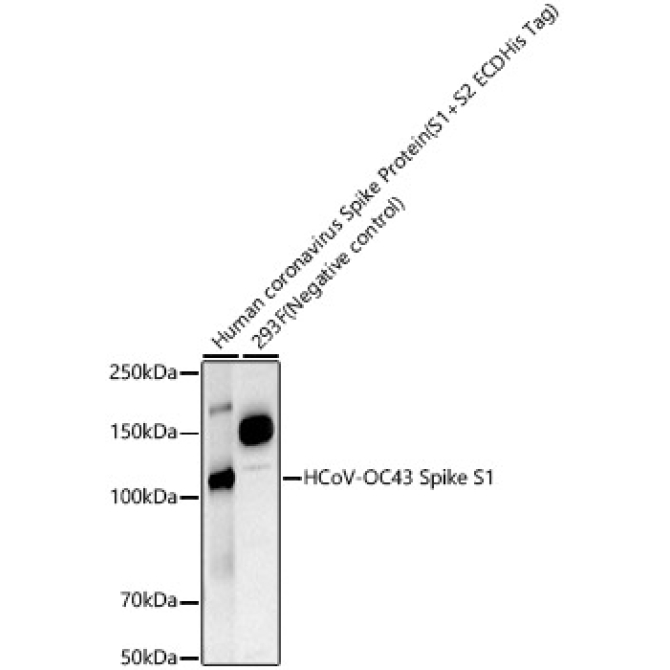 HCoV-OC43 Spike S1 Rabbit Monoclonal Antibody