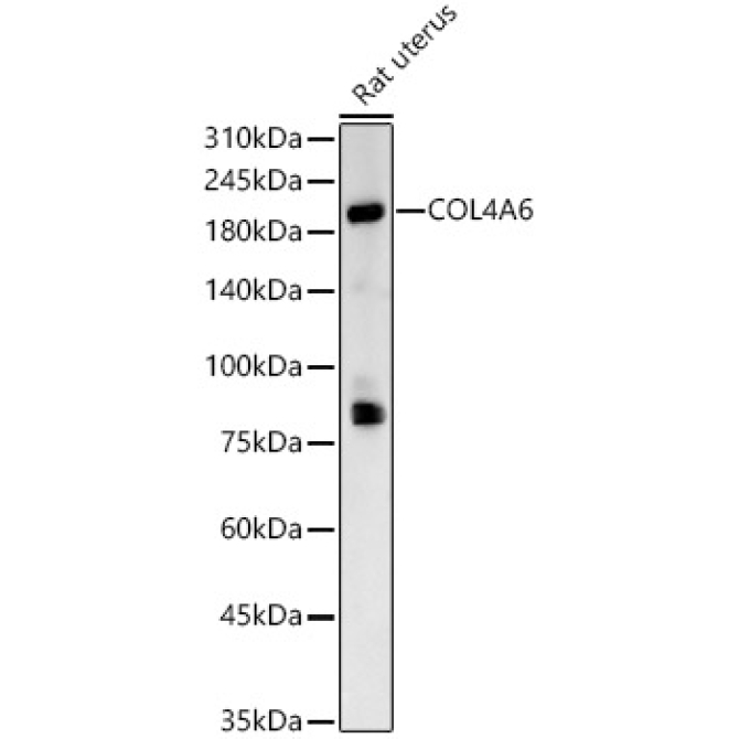 COL4A6 Rabbit Polyclonal Antibody