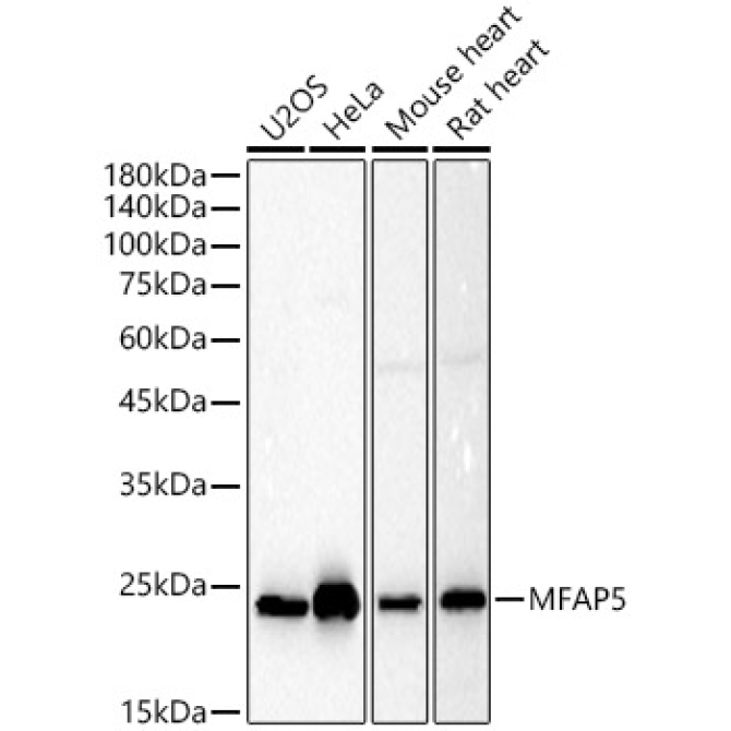 MFAP5 Rabbit Polyclonal Antibody