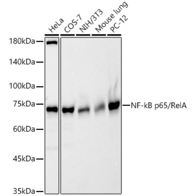 NF-kB p65/RelA Rabbit Polyclonal Antibody [KO Validated]