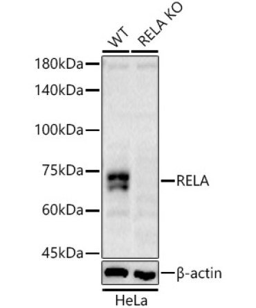 RELA Rabbit Polyclonal Antibody [KO Validated]