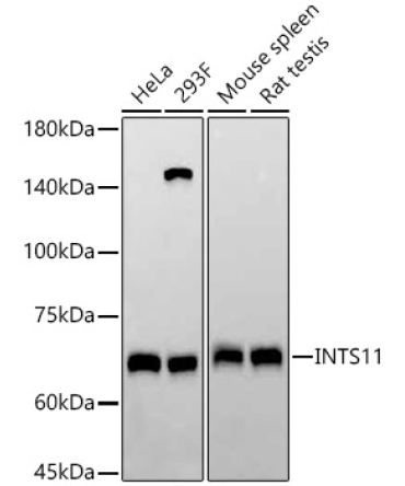 INTS11 Rabbit Monoclonal Antibody