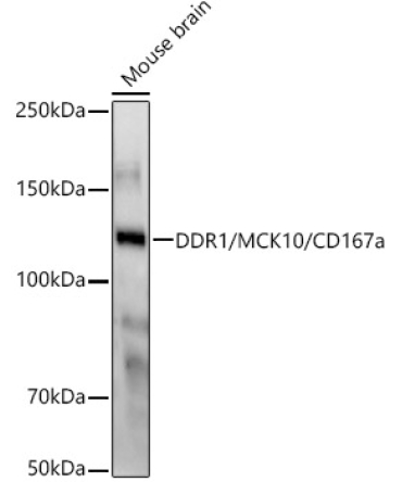 DDR1/MCK10/CD167a Rabbit Monoclonal Antibody