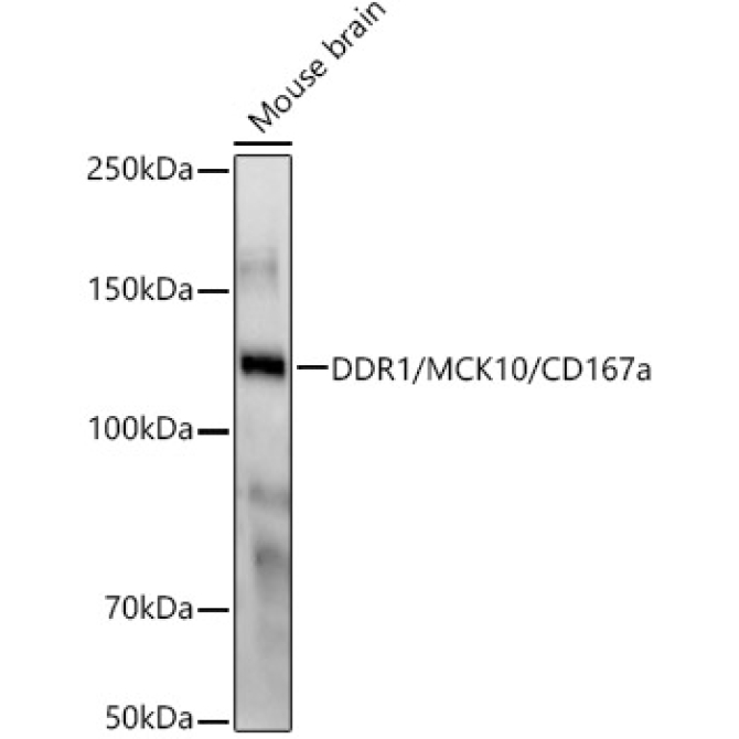 DDR1/MCK10/CD167a Rabbit Monoclonal Antibody