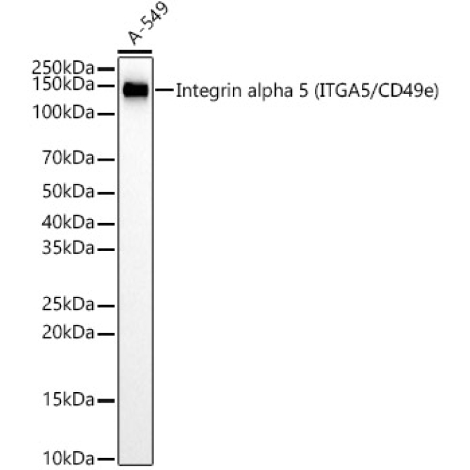 Integrin alpha 5 (ITGA5/CD49e) Rabbit Monoclonal Antibody [KD Validated]