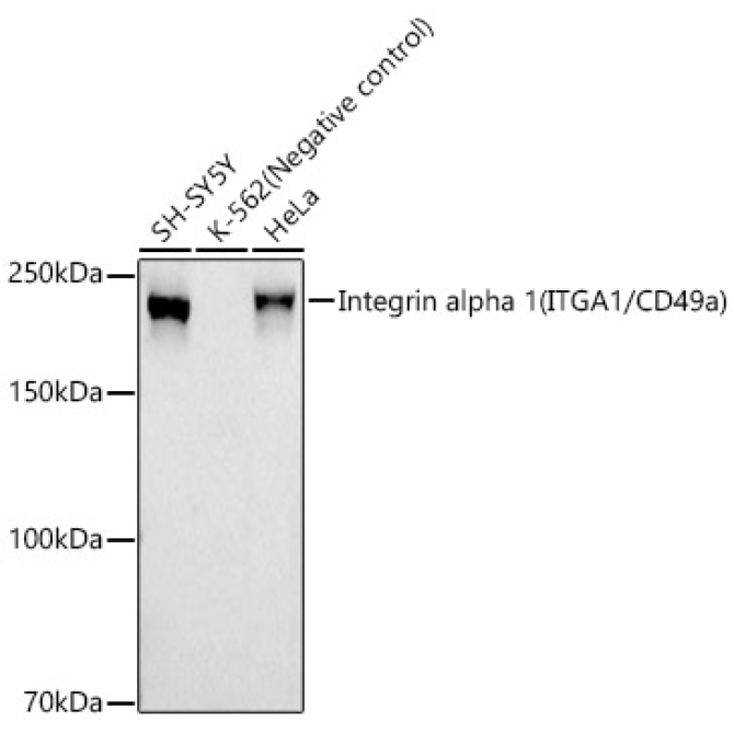 Integrin alpha 1 (ITGA1/CD49a) Rabbit Monoclonal Antibody