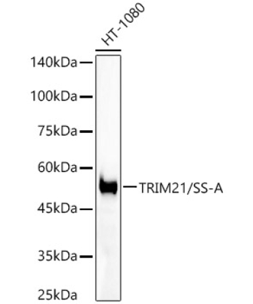 TRIM21/SS-A Rabbit Monoclonal Antibody [KO Validated]