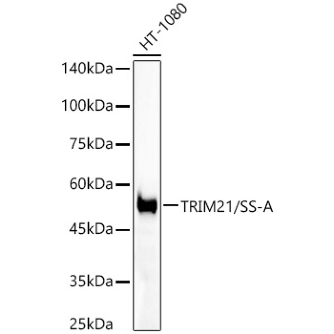 TRIM21/SS-A Rabbit Monoclonal Antibody [KO Validated]