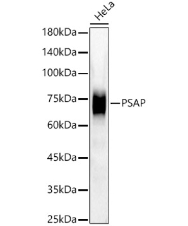 PSAP Rabbit Monoclonal Antibody [KD Validated]