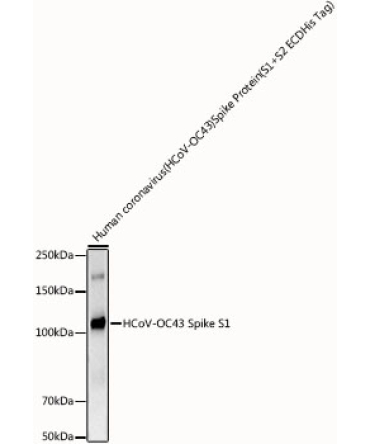 HCoV-OC43 Spike S1 Rabbit Monoclonal Antibody