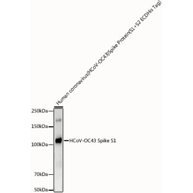 HCoV-OC43 Spike S1 Rabbit Monoclonal Antibody