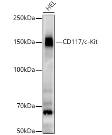 CD117/c-Kit Rabbit Monoclonal Antibody